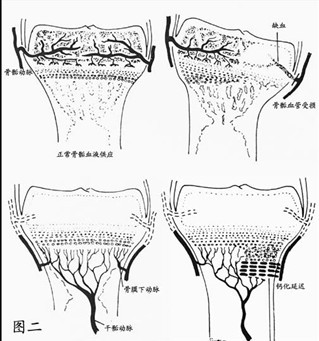 它主要向骨骺板的外周提供软骨细胞,使得骨骺的横径及骨骺板的宽度