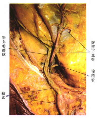 1精索,腹壁下血管的解剖特点:精索起自会阴部,沿耻骨表面向近端循行至