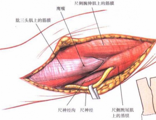 肱二头肌内缘起;肘窝内侧向外转,横切口到肱桡肌