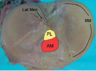 acl并无am,pl明显分束,仅为纤维束;止点均位于胫骨内侧髁间棘内侧,无