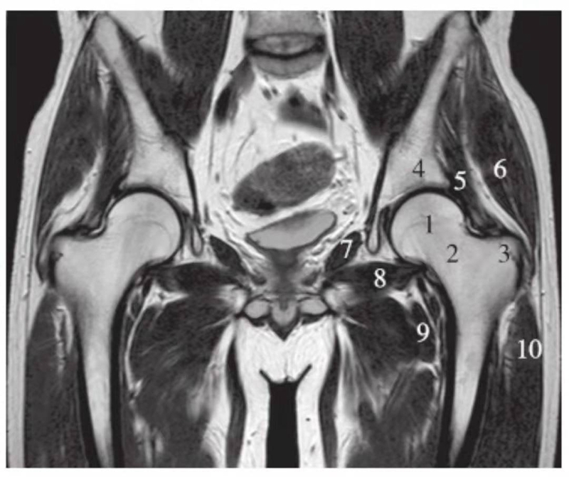 一文掌握正常髋关节mri解剖示意图