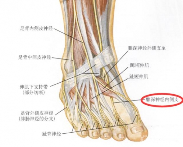 足底内侧皮神经,足底外侧皮神经)区域,腓肠神经(跟内侧支)区域的损伤