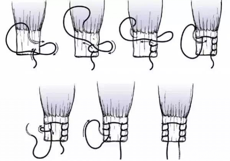 外科13种缝合方法图片