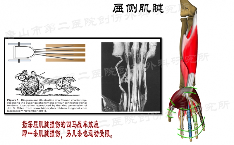 閱圖理解一文掌握手部肌腱的修復