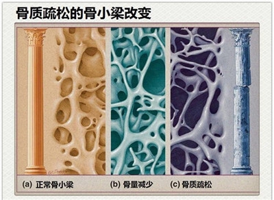 43張圖帶您探索骨科的神奇世界