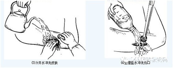 瞭解清創縫合術