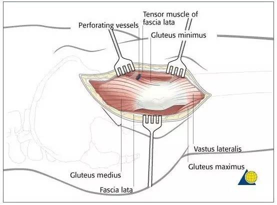 vastus medialis图片