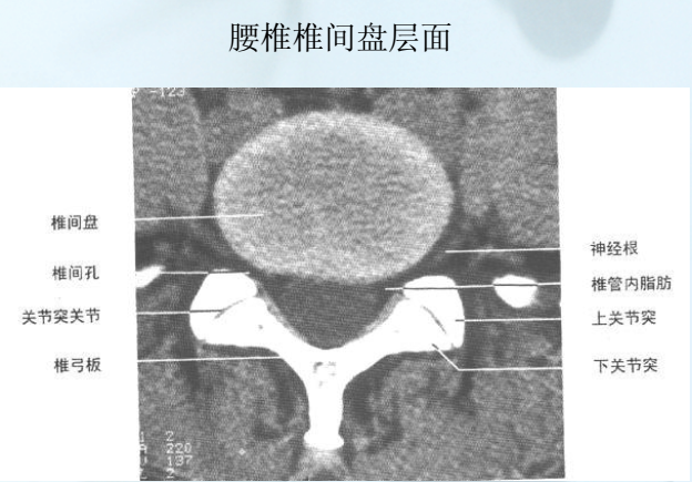 脊柱主要体表标志 第7颈椎棘突最长;第3胸椎棘突平肩胛冈内侧端;第7