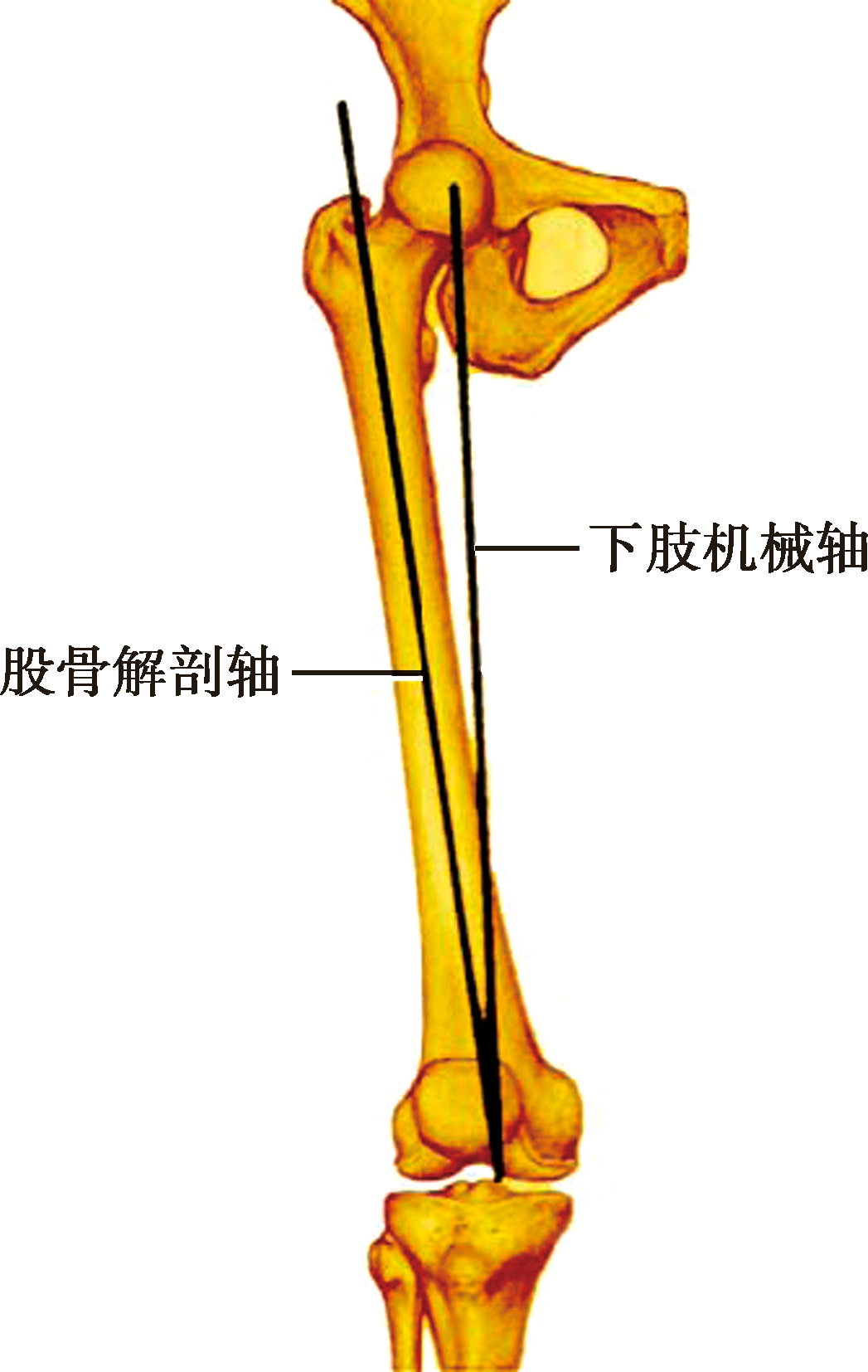 远端股骨角下肢负重轴即躯体垂直轴,也称躯体纵轴线