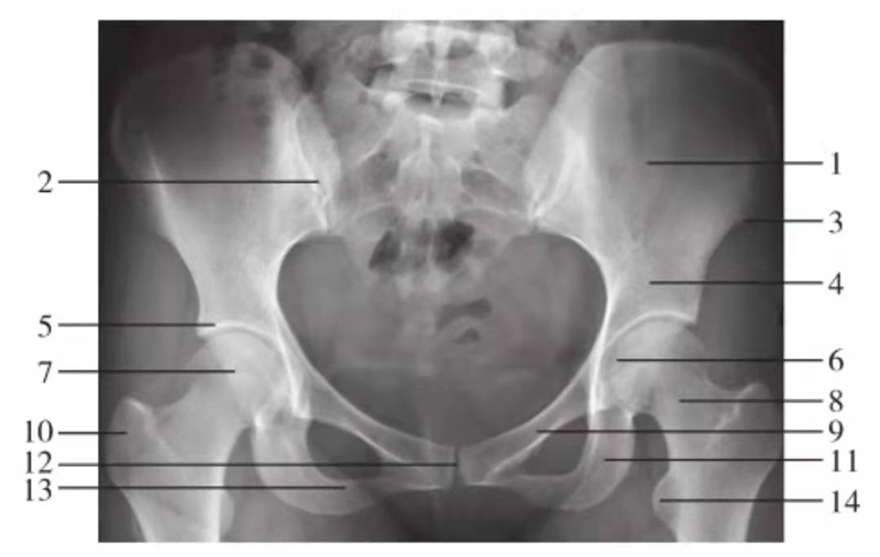 一文掌握正常髖關節x線解剖示意圖