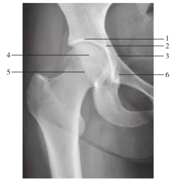 正常骨盆x光片结构图片