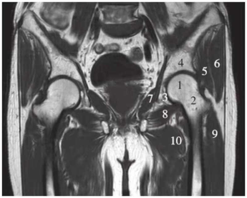 一文掌握正常髋关节mri解剖示意图
